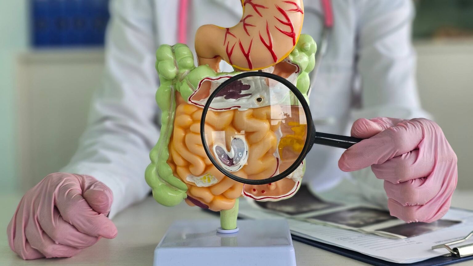 Νόσος του Crohn: Πώς μια απλή εξέταση αίματος μπορεί να την προβλέψει χρόνια πριν από τα συμπτώματα