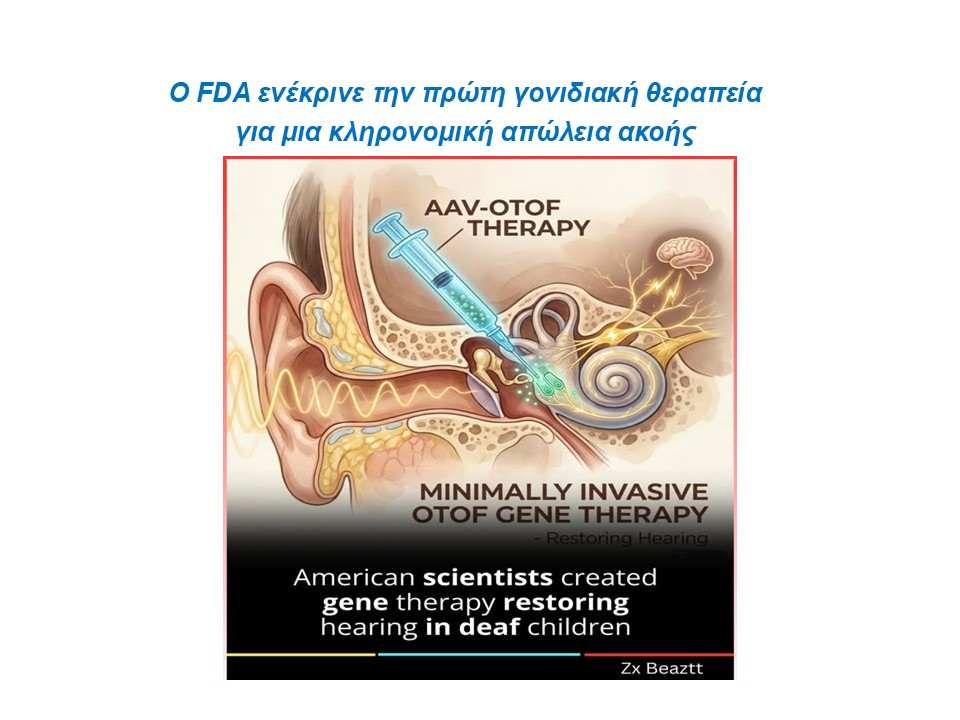 Ο FDA ενέκρινε την πρώτη γονιδιακή θεραπεία για μια κληρονομική απώλεια ακοής.
